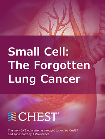 Small Cell: The Forgotten Lung Cancer (Limited and Extensive Stage)