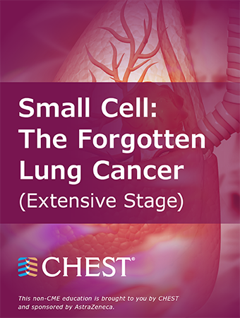 Small Cell - The Forgotten Lung Cancer: Extensive Stage